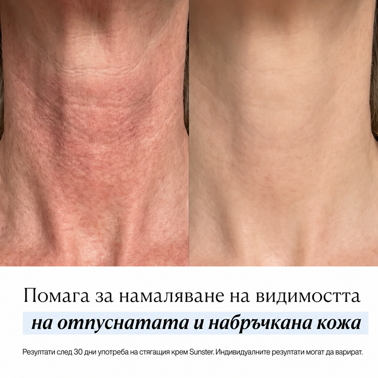 Стягащ и Тонизиращ Крем За Тяло